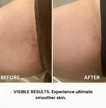 Trimora - 2 in 1 Bikini & Body Trimmer